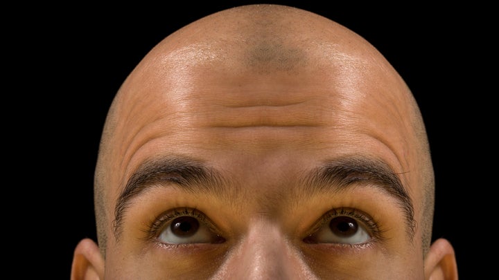Bald man looking up