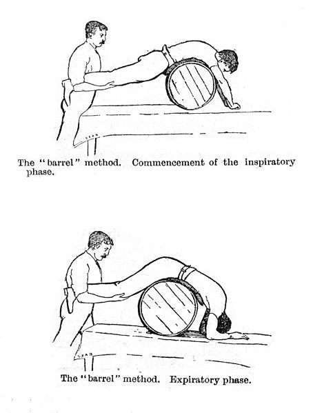 a diagram of a man rolling another man on a barrel