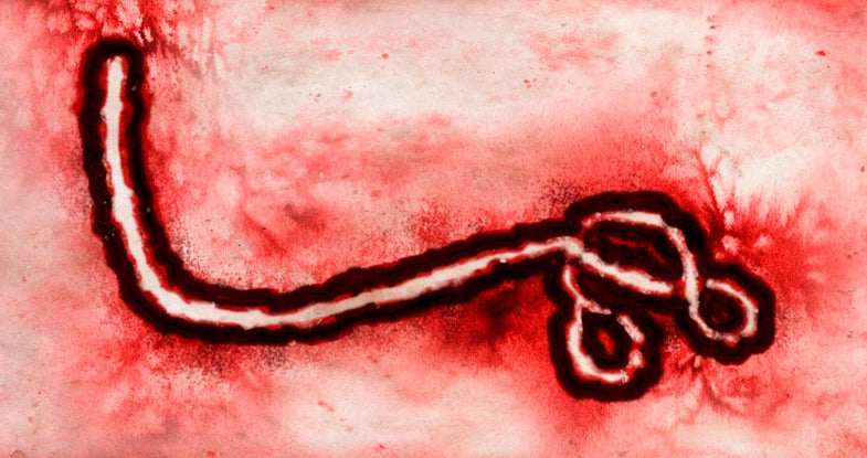 Microscopic view of the Ebola virus