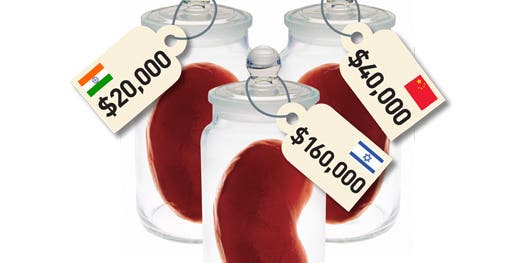 Which Organs Can I Live Without, And How Much Cash Can I Get For Them?