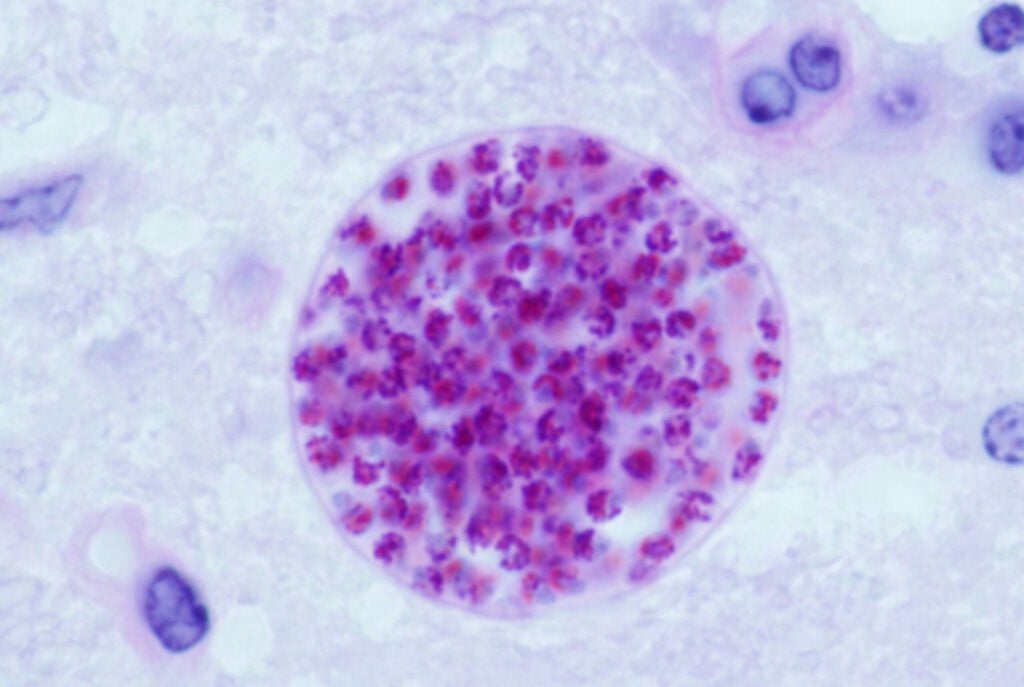 _Toxoplasma gondii_ parasites form a cyst in a mouse brain.