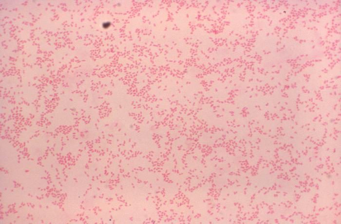 This bacteria, which causes miscarriages and stillbirths in dogs, is spread through vaginal secretions, urine, and potentially saliva. In humans, <em>B. canis</em> can cause fever, fatigue, and weight loss, as well as swelling of the liver, spleen, and lymph nodes. The disease is rare in humans, but <a href="http://www.nasphv.org/Documents/BrucellaCanisInHumans.pdf">probably underdiagnosed</a>. <strong>Prevention:</strong> Wash your hands after touching your pet.