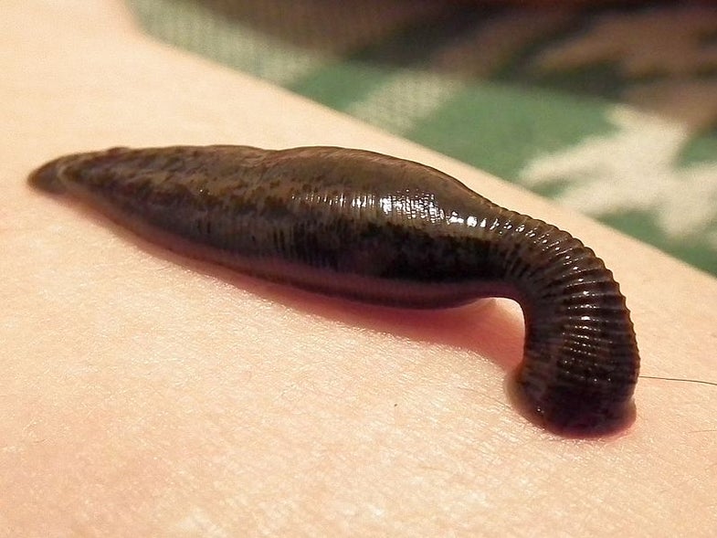 The medicinal leech, Hirudo medicinalis. Leeches have been found "just about everywhere you can imagine" inside the human body, says emergency physician Jeremy Joslin.