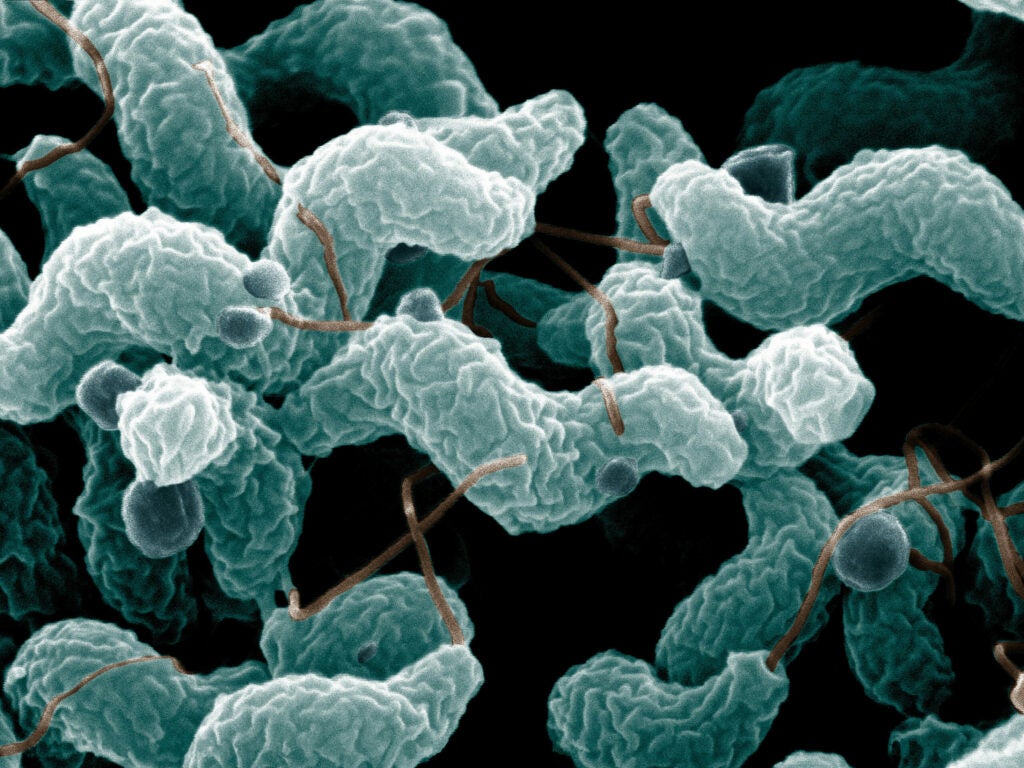 It may look like spiral-shaped macaroni, but you do not want to eat this microbe. <em>Campylobacter jejuni</em> is one of the most common causes of food poisoning. (You know the symptoms.) Though it's commonly spread through improperly cooked meats, <em>C. jejuni</em> is also present in the feces of cats and dogs, where it can <a href="http://www.ncbi.nlm.nih.gov/pmc/articles/PMC356901/">spread to humans</a>. <strong>Prevention:</strong> Wash your hands before eating.