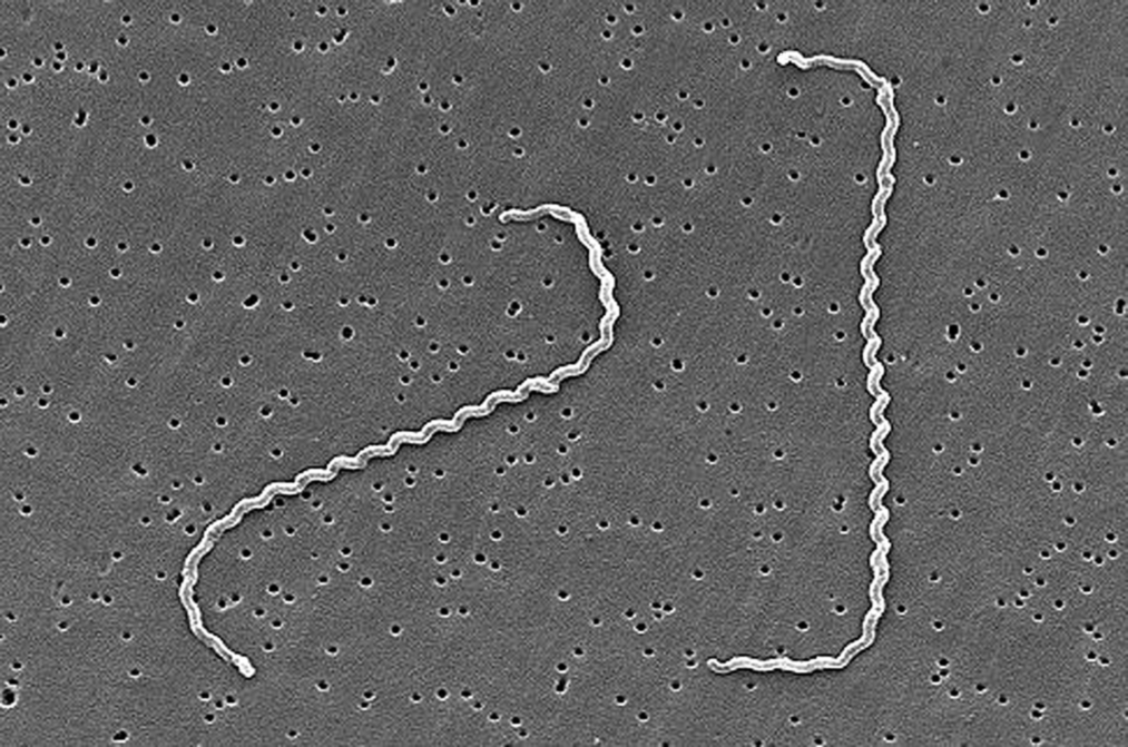 This spiral-shaped bacteria, which resides in the urine of various pets, can corkscrew its way through your skin and into the bloodstream. From there, <em>L. interrogans</em> causes fever, vomiting, and diarrhea. If left untreated, the infection can lead to kidney damage, meningitis, liver failure, and <a href="http://www.cdc.gov/leptospirosis/index.html">even death</a>. <strong>Prevention:</strong> Avoid the urine of cats, dogs, and rodents. Do not swim in water that may have been peed in by these animals.