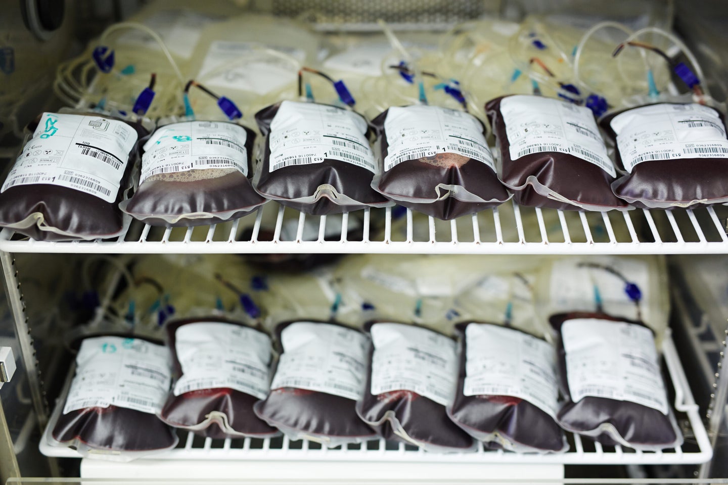 Please don’t pay $8,000 for an infusion of young blood