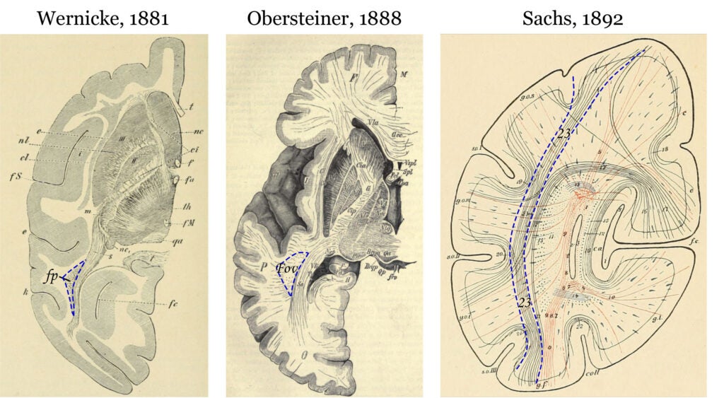 VOF brain structure