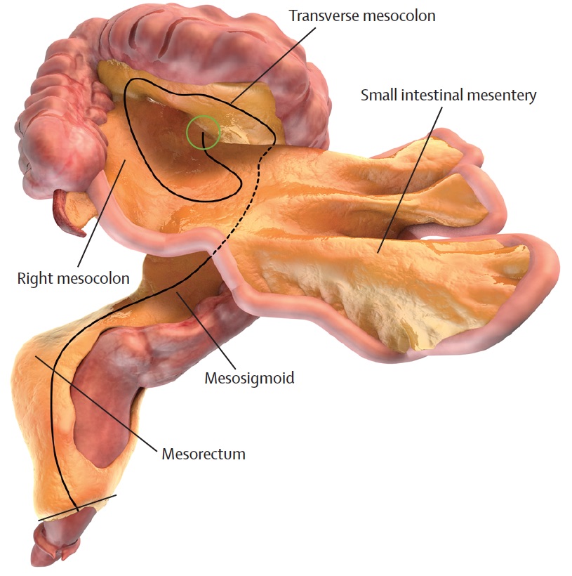 Digital representation of the intestines and mesentery.