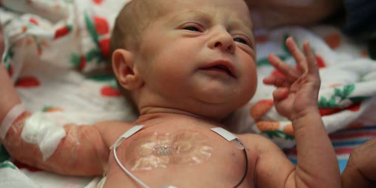 Wearable sensors designed for premature babies could make us all healthier
