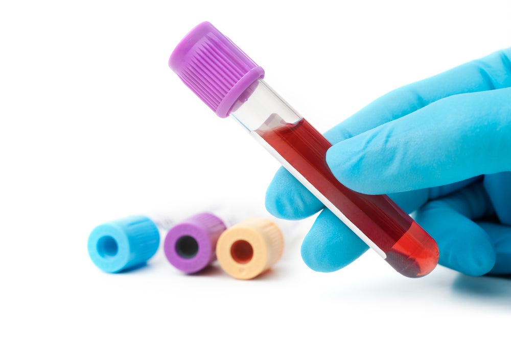HIV remission blood test