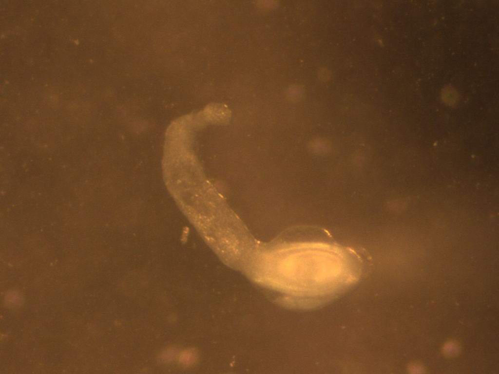 Larval stage of Hymenolepis diminuta.