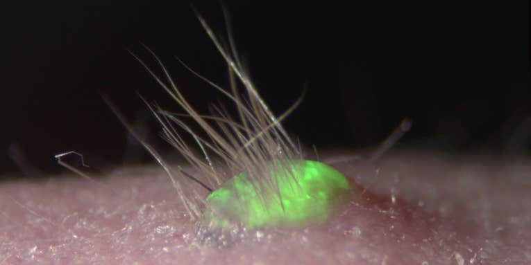 Mouse Skin, Complete With Fur, Grown In Lab