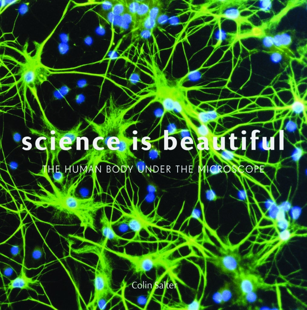 To get more microscopic views of the human body, check out the book--available on <a href="http://www.amazon.com/Science-Beautiful-Human-Under-Microscope/dp/1849941920/ref=sr_1_1?s=books&amp%3Bie=UTF8&amp%3Bqid=1422988355&amp%3Bsr=1-1&tag=camdenxpsc-20&asc_source=browser&asc_refurl=https%3A%2F%2Fwww.popsci.com%2Fscience%2Fnew-book-looks-human-body-under-microscope&ascsubtag=0000PS0000114337O0000000020230531200000%20%20%20%20%20%20%20%20%20%20%20%20%20%20%20%20%20%20%20%20%20%20%20%20%20%20%20%20%20%20%20%20%20%20%20%20%20%20%20%20%20%20%20%20%20%20%20%20%20%20%20%20%20%20%20%20%20%20%20%20%20">Amazon</a> and other book retailers. [<a href="http://www.barnesandnoble.com/w/science-is-beautiful-colin-salter/1120170016?cm_mmc=google+product+search-_-q000000633-_-9781849941921pla-_-book_under5-_-q000000633-_-9781849941921&amp;ean=9781849941921&amp;isbn=9781849941921&amp;kpid=9781849941921&amp;r=1">Hardcover: $25</a>]