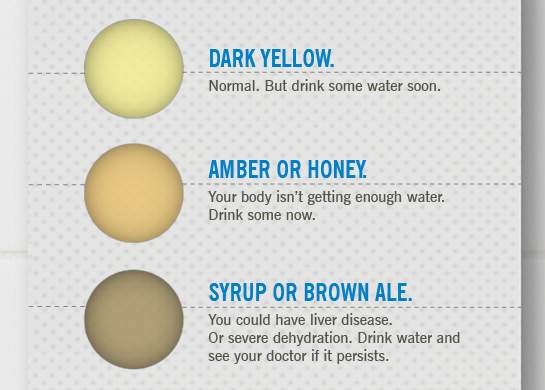 Is Your Pee The Right Color? [Infographic]