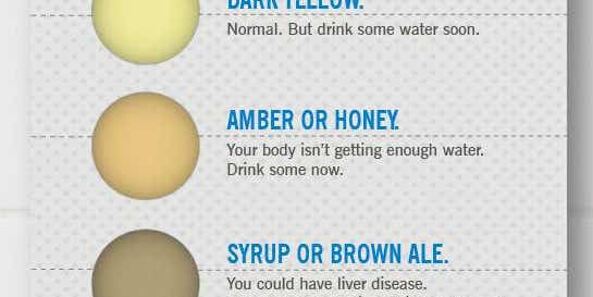 Is Your Pee The Right Color? [Infographic]