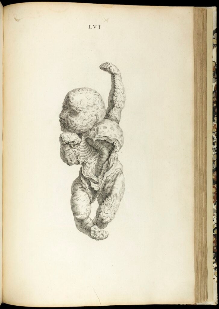 This is an image from English surgeon William Cheselden's <em>Osteographia, or the Anatomy of the Bones</em>. We haven't been able to track down what, exactly, it depicts, although something seems wrong, doesn't it? Cheselden put a lot of money into <em>Osteographia</em>, which was large and featured dozens of engravings, but it did not sell well. Costly and time-consuming to make, anatomical atlases of the time were often financial failures, the <a href="http://www.nlm.nih.gov/exhibition/historicalanatomies/cheselden_bio.html">U.S. National Library of Medicine notes</a>. If only Cheselden could have known—copies of his book <a href="http://www.christies.com/lotfinder/books-manuscripts/cheselden-william-osteographia-or-the-anatomy-of-4959925-details.aspx">now</a> <a href="http://www.abebooks.com/Osteographia-Anatomy-Bones-INSCRIBED-WILLIAM-CHESELDEN/659280381/bd">sell</a> for tens of thousands of dollars.