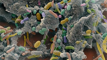 Researchers Restored A Colony Of Microbes In The Gut