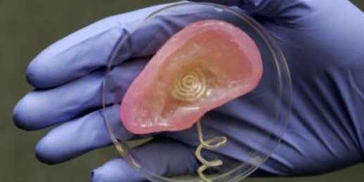 Scientists 3-D Print A Bionic Ear With Help From A High School Kid