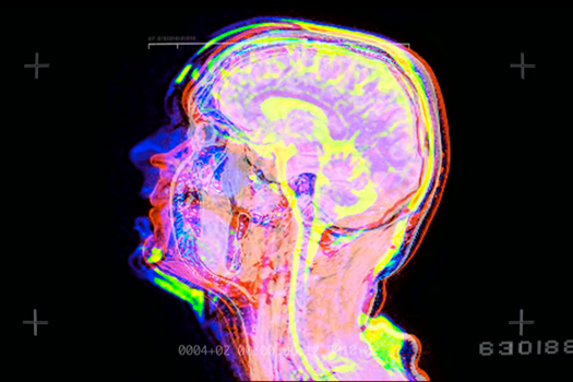 Watching Your Brain Freak Out On A Scanner Calms You Down