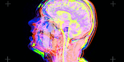 Watching Your Brain Freak Out On A Scanner Calms You Down