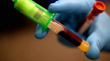 Blood Test Could Detect A Genetic Tendency Toward Suicide