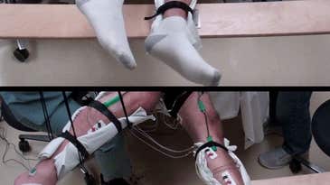 New Treatment Lets Paralyzed Patients Move Their Legs