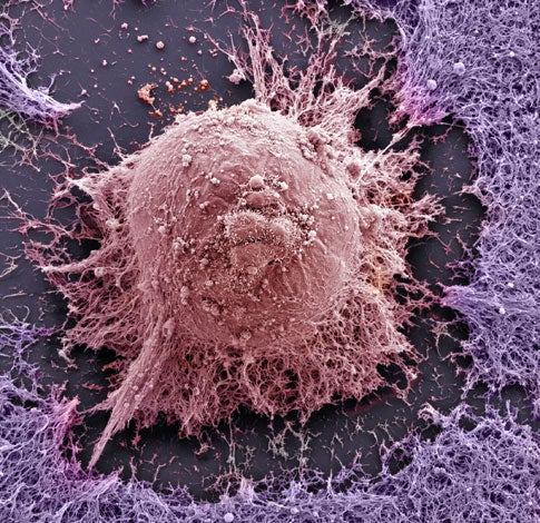 A microscopic view of a human embryonic stem cell