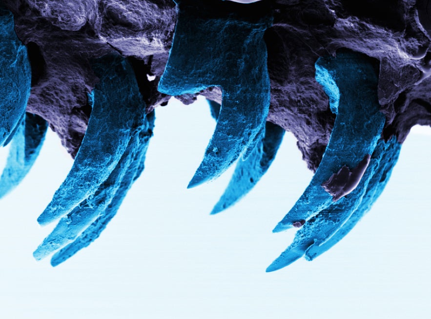 This year, <a href="https://www.popsci.com/snails-teeth-have-just-dethroned-spiders-silk-strongest-biological-material/">limpet's teeth</a> became the strongest biological substance, bumping spider's silk down to second place. Here's a view of the super small teeth attached to the sea snail's tongue.