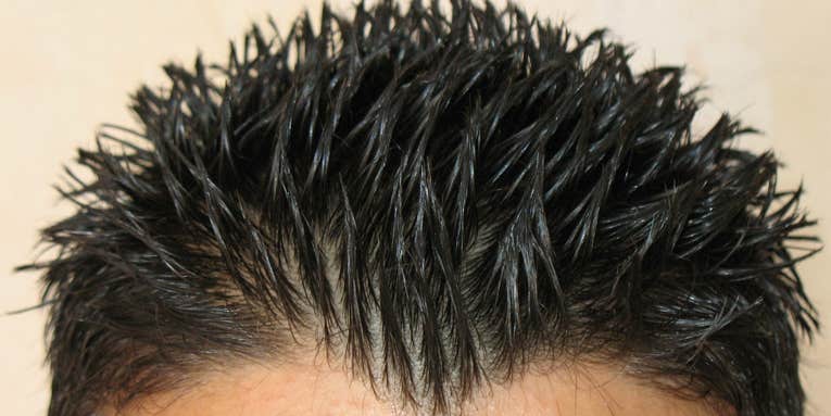 The Bacteria On Your Scalp Could Be Key To Fighting Dandruff