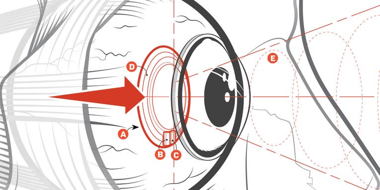 Contact Lens Sees Eye Disease Before It Strikes