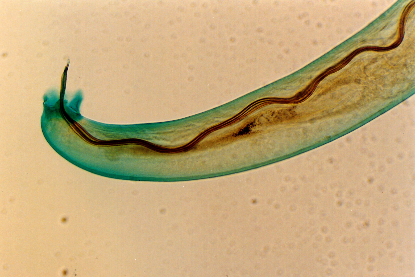 Two people got rat lungworm from eating raw centipedes. Could you be next?