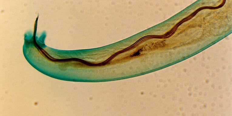 Two people got rat lungworm from eating raw centipedes. Could you be next?