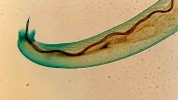lungworm angiostrongylus cantonensis