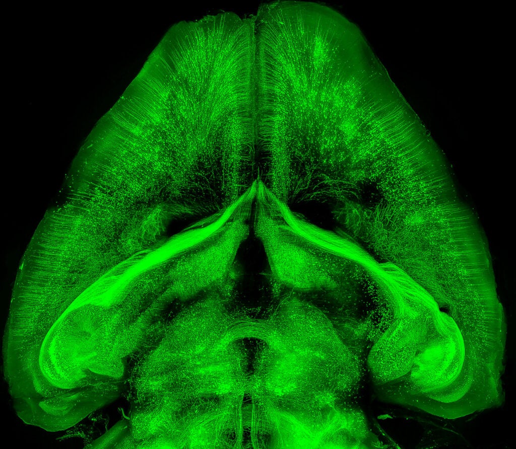 transparent mouse brain