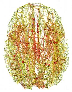 This image shows the group connectome, with the nodes and connections colored according to their rich-club participation. Green represents few connections. Red represents the most.