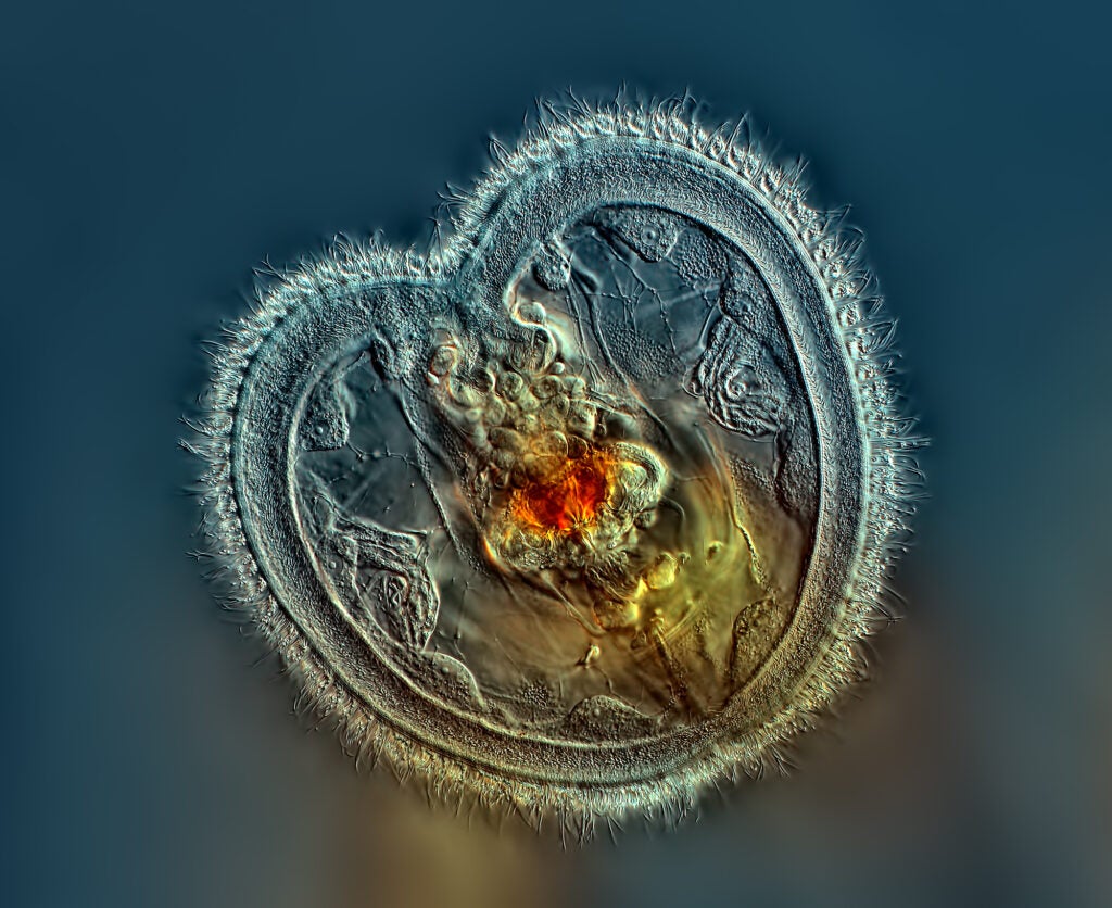 Rotifer showing the mouth interior and heart-shaped corona