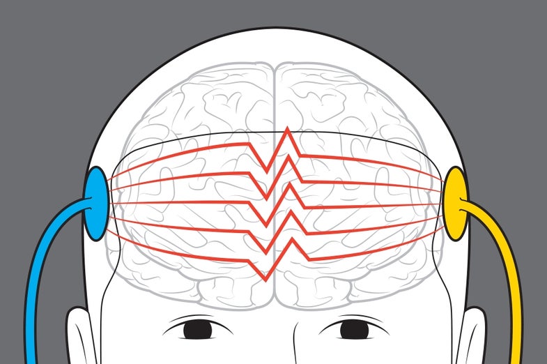 Scientists and amateurs alike have been testing the effects of sending electrical currents across the scalp.