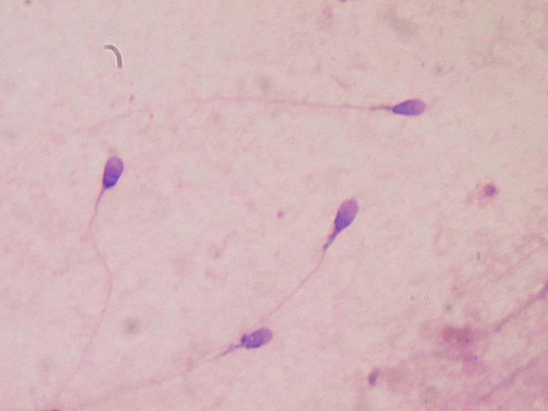 Study Shows Females Can Delay the Aging of Sperm Cells for Decades