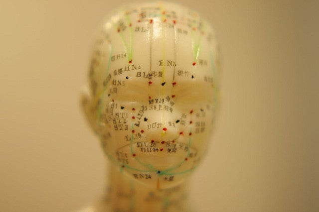 Why it’s so hard to figure out if acupuncture actually works