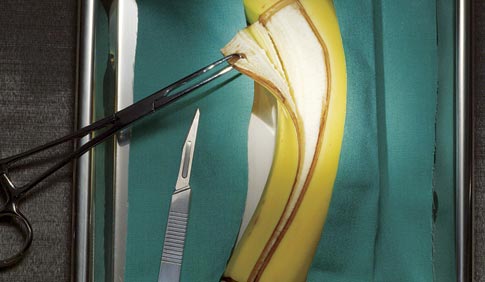 banana operation