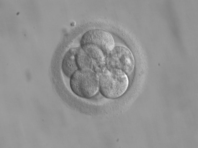 Baby Born From 20-Year-Old Frozen Embryo