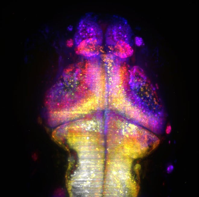 Imaging activity in the brains of young zebrafish