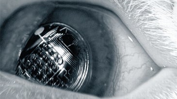 Electronic Contact Lenses Tested Successfully in Real Live Eyes
