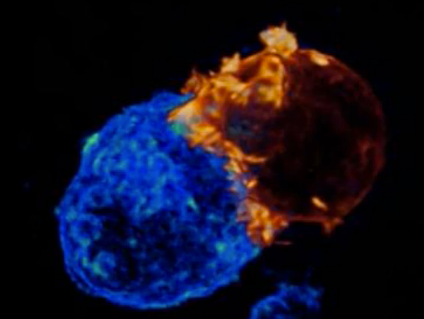WATCH THE VIDEO! We may know T cells as the attack dogs of the immune system. But rarely do we get to see them face off against disease-causing cells. In this video, the T cell (orange) faces off against a cancer cell (blue) ---and wins.