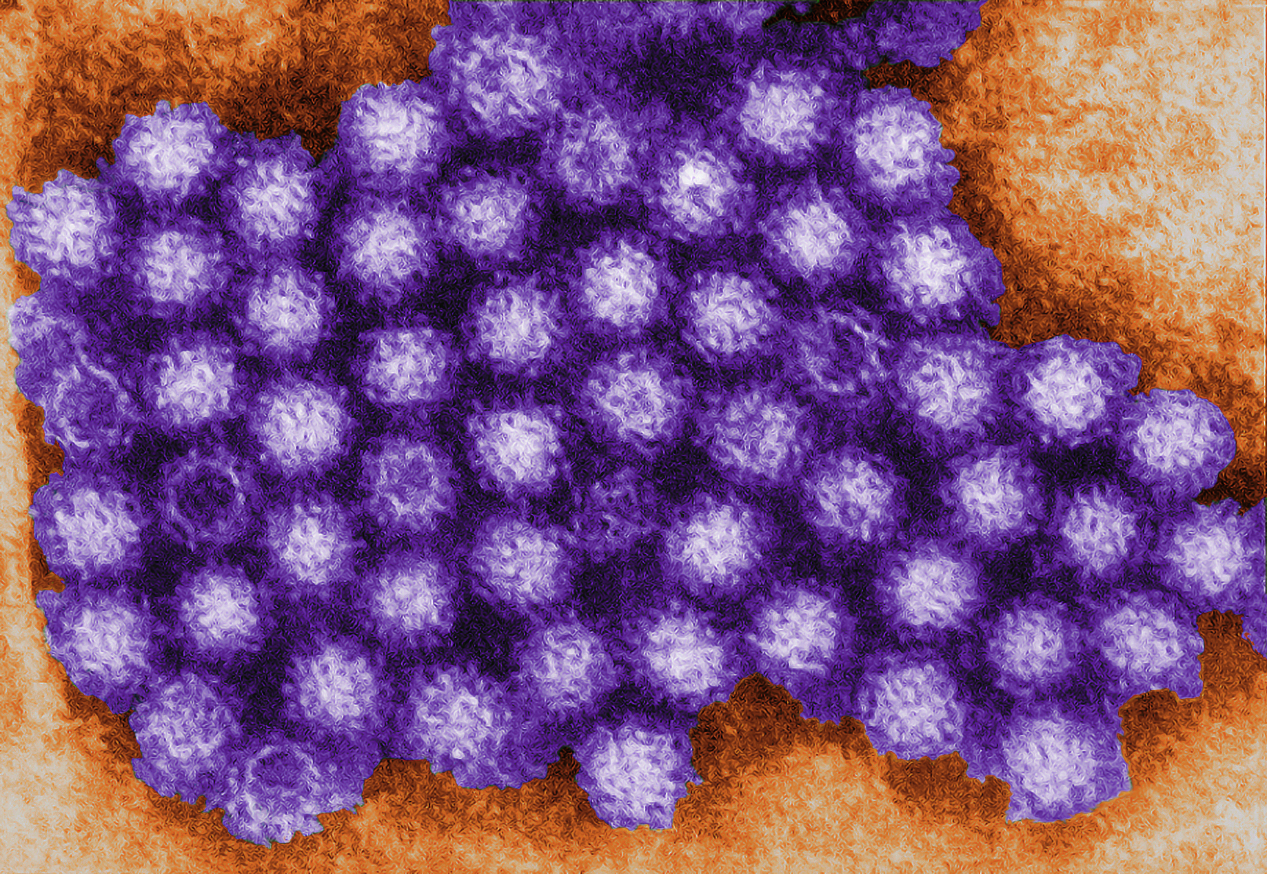 Transmission electron micrograph reveals norovirus virions, or virus particles.