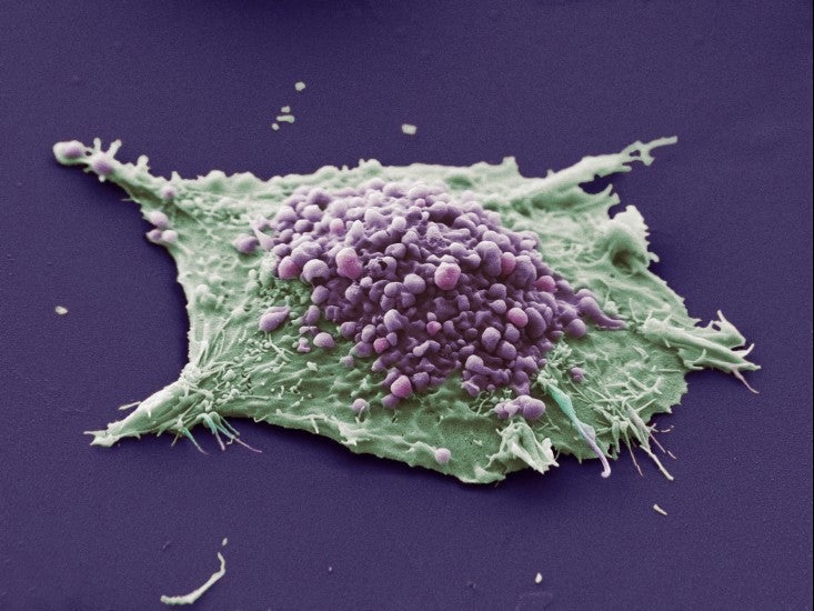 This image shows a single cell grown from a culture of lung epithelial carcinoma (cancer) cells. The purple area shows the formation of irregular bulges in the cell membrane, in a process called blebbing. Blebbing is important in a variety of cellular processes. The green area shows an area of the cell where the blebbing is not occurring or is not visible. [<a href="http://www.wellcomeimageawards.org">Wellcome Image Awards</a>]