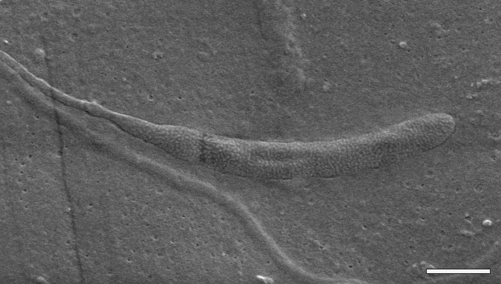 50-Million-Year-Old Worm Sperm Found Preserved In Antarctica