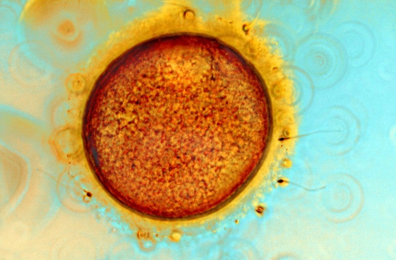 What looks like an artist's rendering of the sun is actually a human egg cell. The egg cell is much larger than the sperm attached to it, and is surrounded by protective cells around its outside surface (shown in yellow). The brown membrane surrounding the egg cell is the zona pellucida. The head of the sperm carries special enzymes to dissolve this membrane, which it must do in order to fertilise the egg. [<a href="http://www.wellcomeimageawards.org">Wellcome Image Awards</a>]