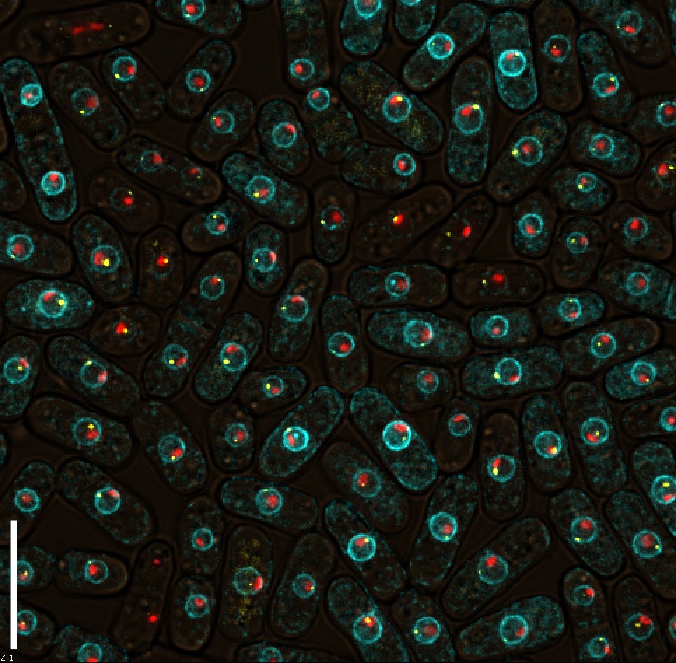 These cheerful little dots are cancer. Here's what GE says: "Yeast expressing fluorescent fusion proteins marking nucleoli (red), centromeres (yellow) and the nuclear envelope and plasma membrane (cyan)."