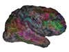 A 3D view of a person's cerebral cortex.